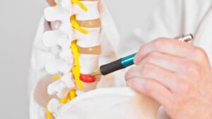 (MILD) Minimally Invasive Lumbar Decompression - Best Tips
