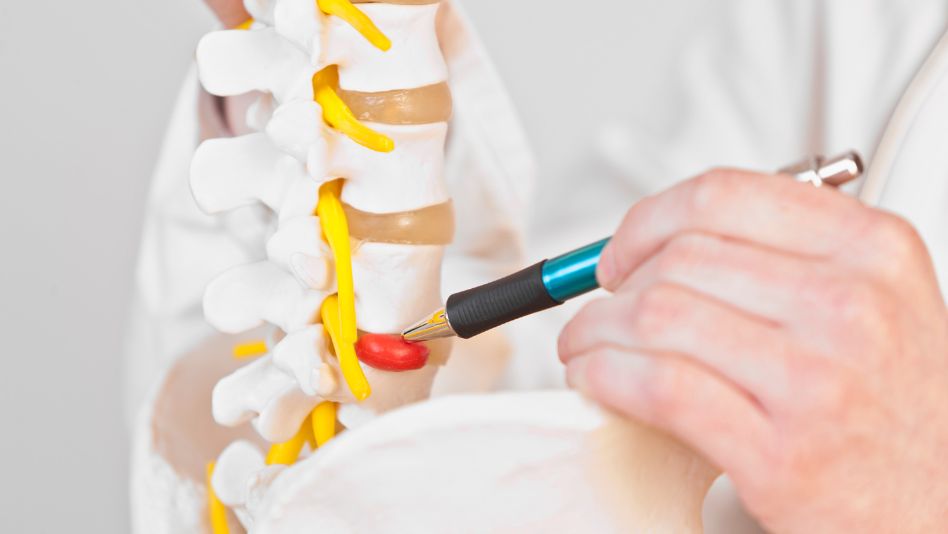 Minimally Invasive Lumbar Decompression - Silky Patel