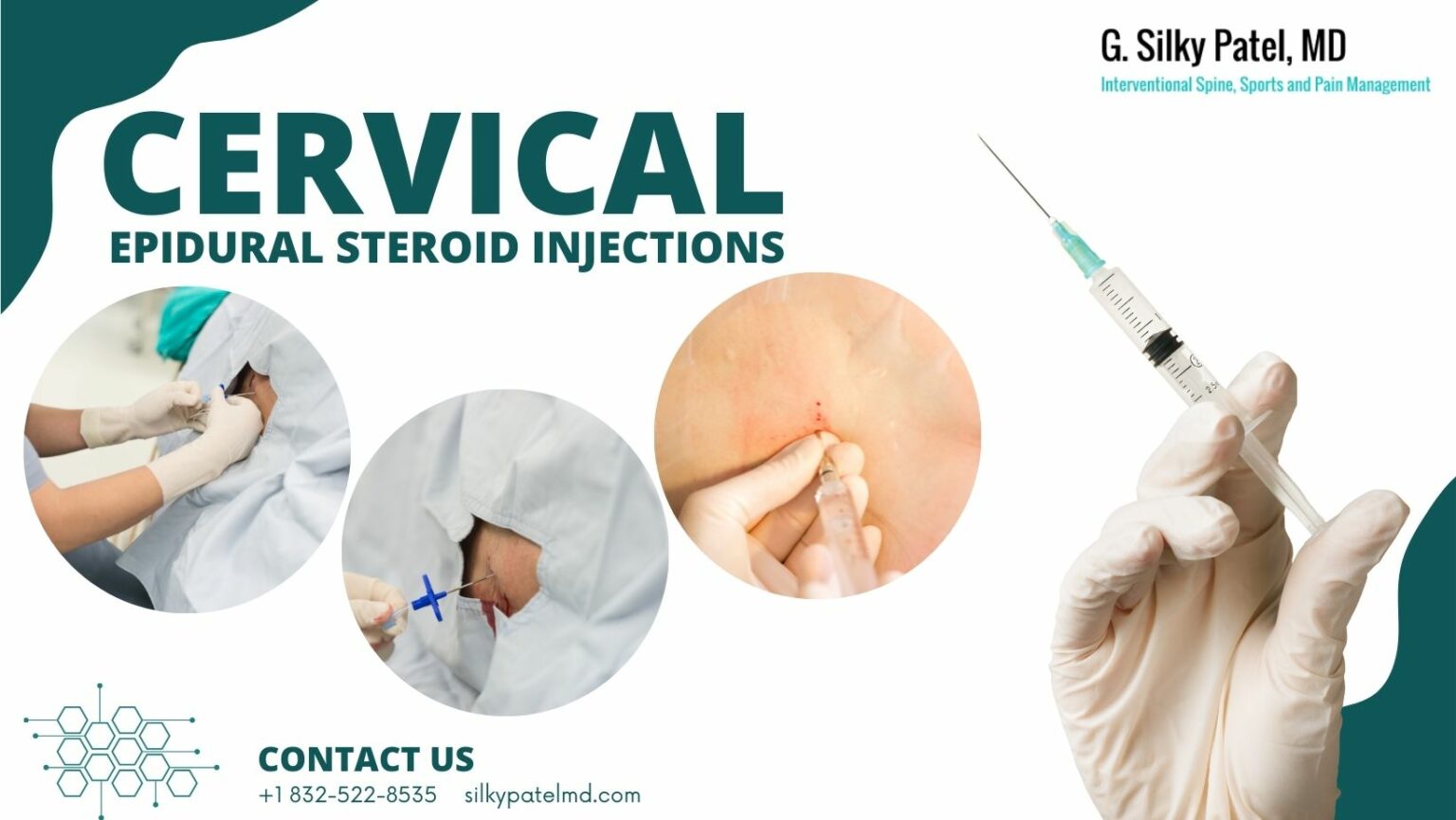 Epidural Steroid Injections And Treatment In Houston Texas 3741