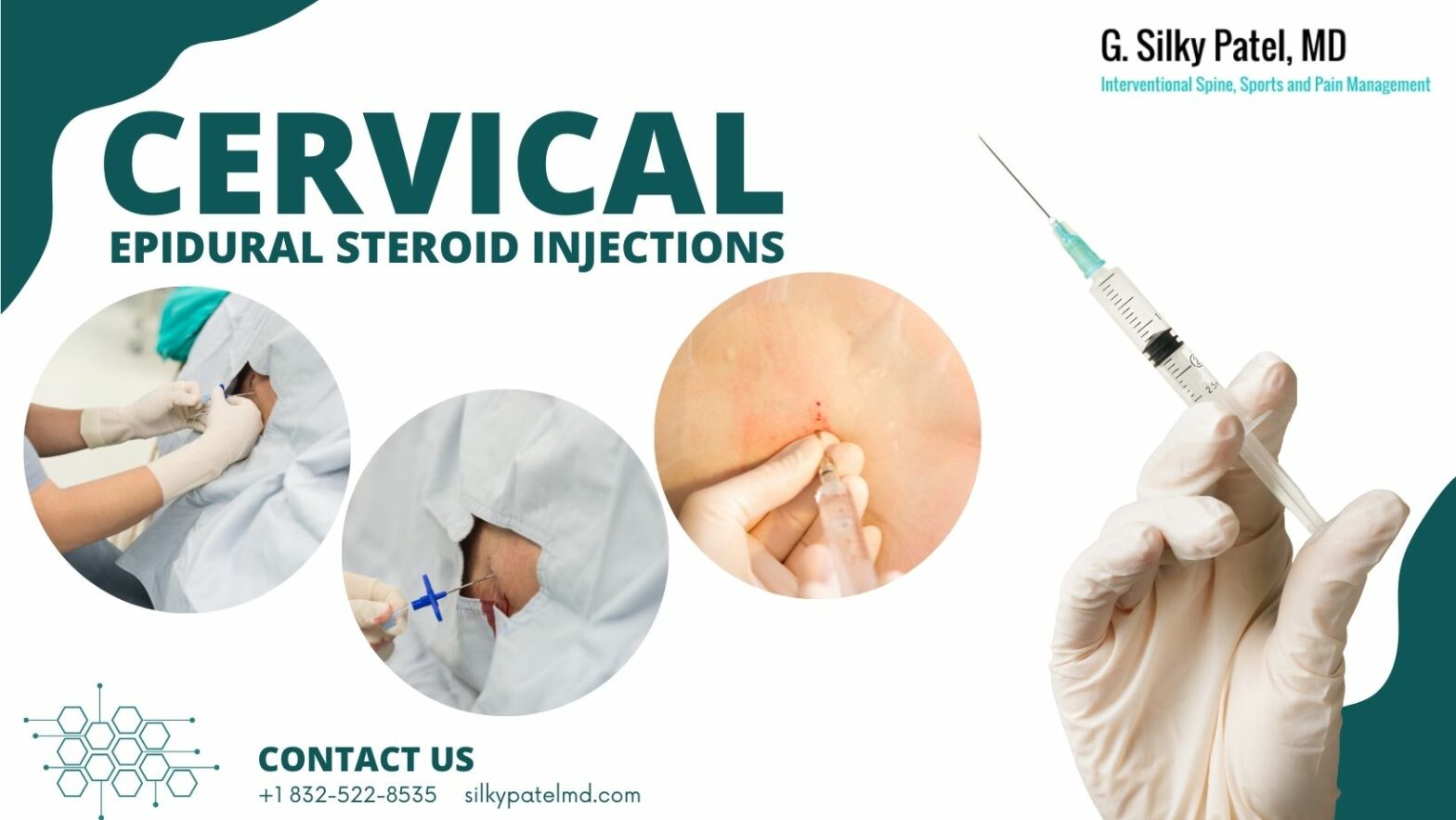 Cervical Epidural Steroid Injections in Houston