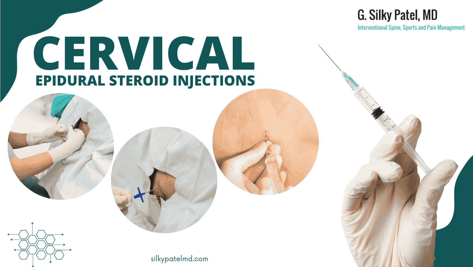 Cervical Epidural Steroid Injections in Houston - Silky Patel