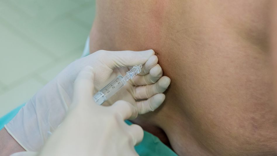The Vertiflex Procedure and Its Effective Treatment For Lumbar Spinal Stenosis - Silky Patel