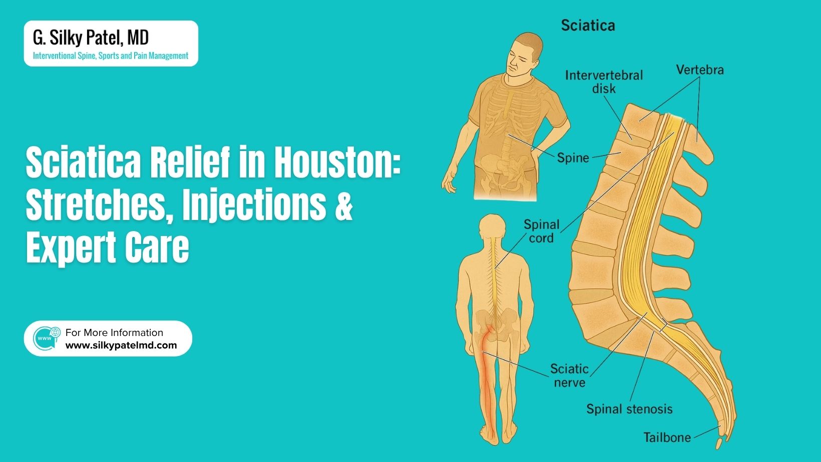 Sciatica Relief in Houston_ Stretches, Injections & Expert Care - Silky Patel