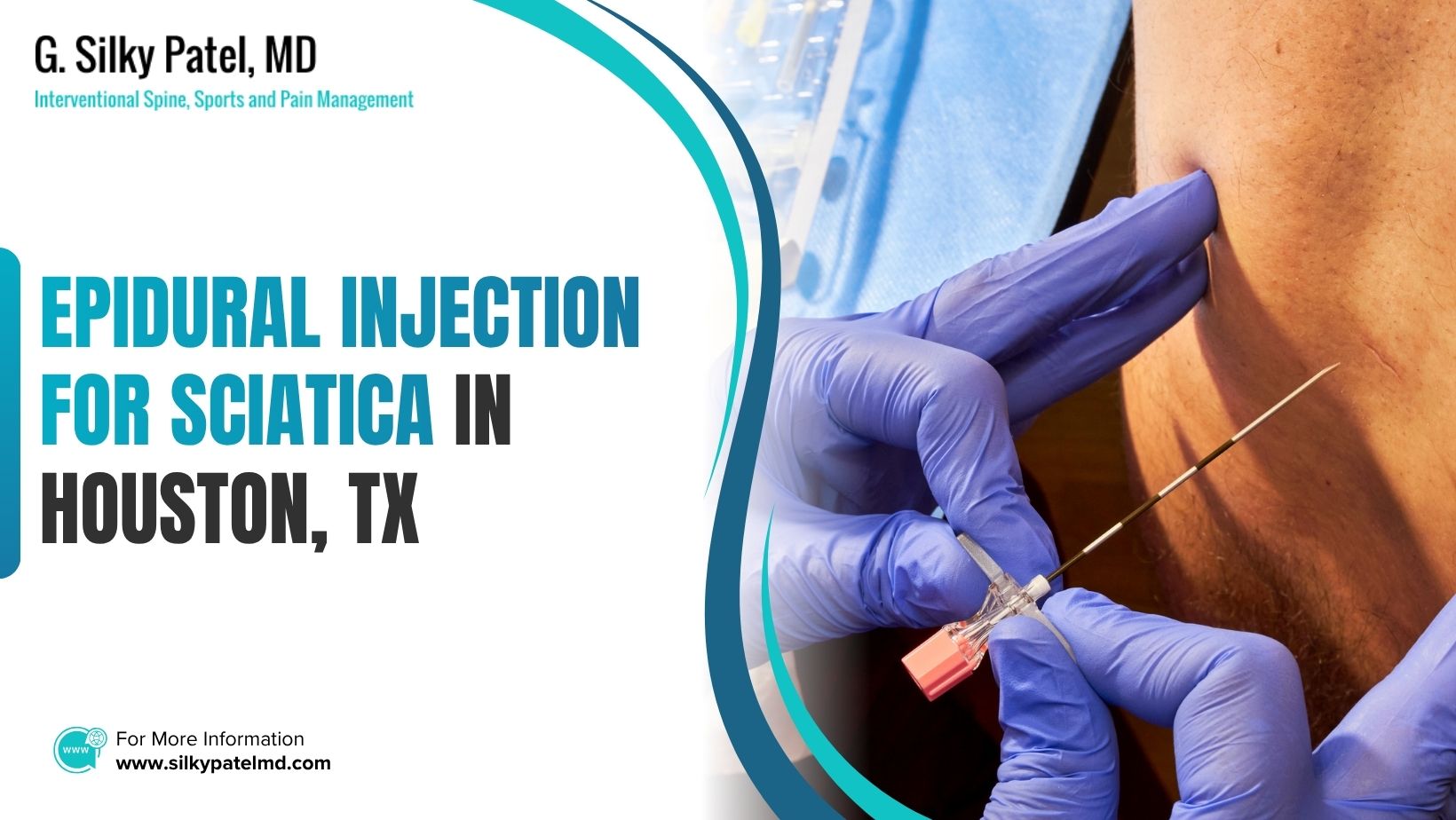 epidural injection for sciatica - Dr. Silky Patel MD